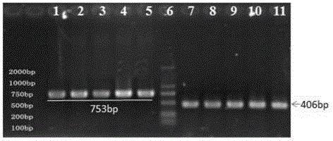 与水稻抗白叶枯病基因紧密连锁的分子标记OSblb-SV4