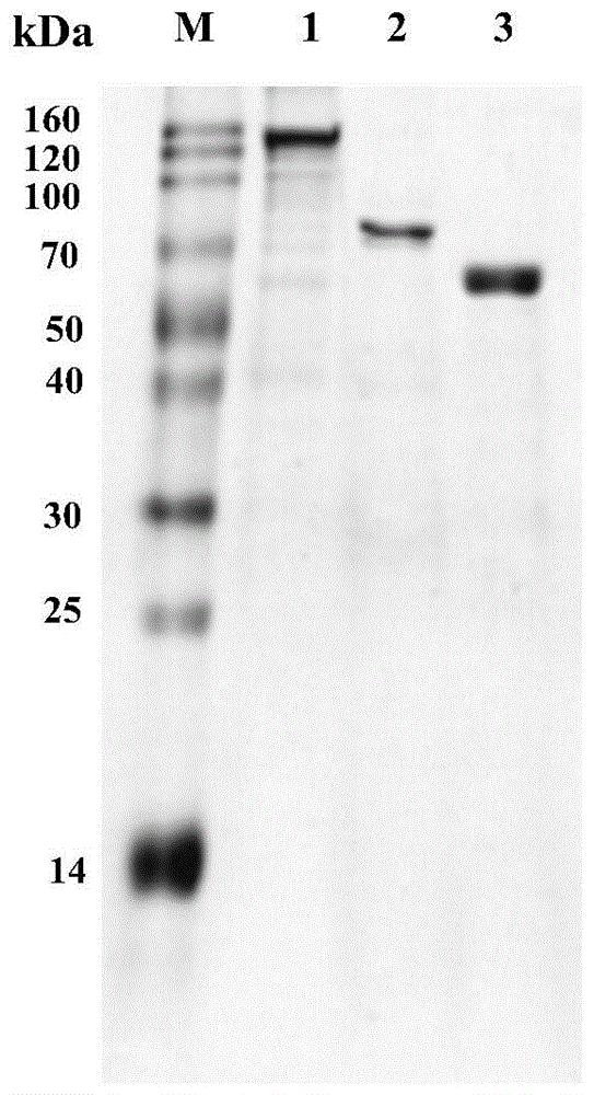 一种重组几丁质酶及其相关生物材料与应用