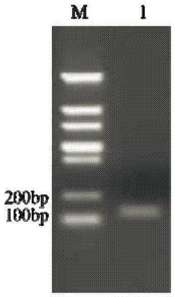 在重组毕赤酵母中高效表达抗菌肽NZ2114的方法