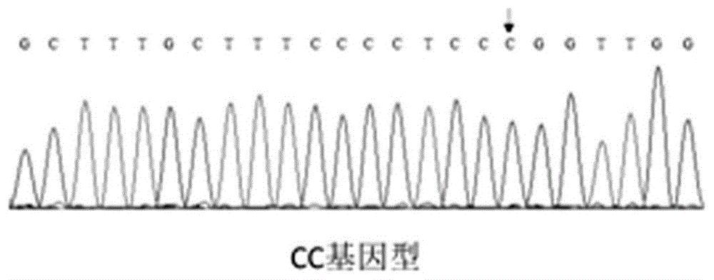 一种影响猪肌纤维密度的SNP分子标记及其应用