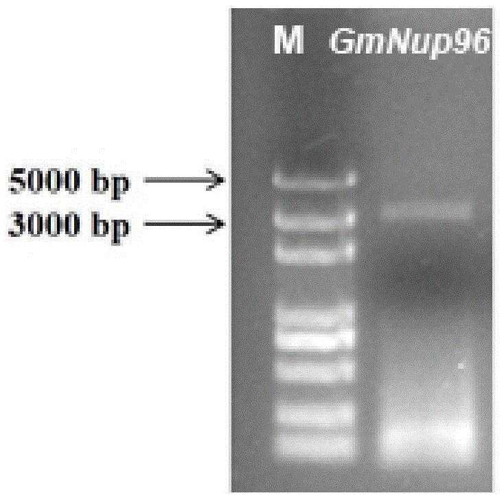 大豆核孔蛋白基因GmNup96在调节植物根瘤发育中的应用