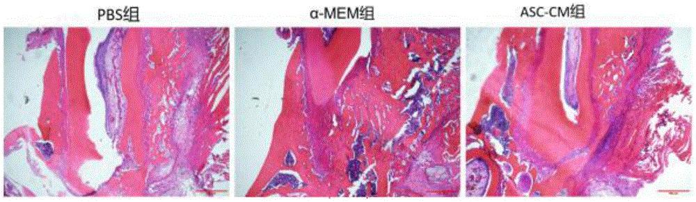 鹿茸干细胞条件培养基的用途