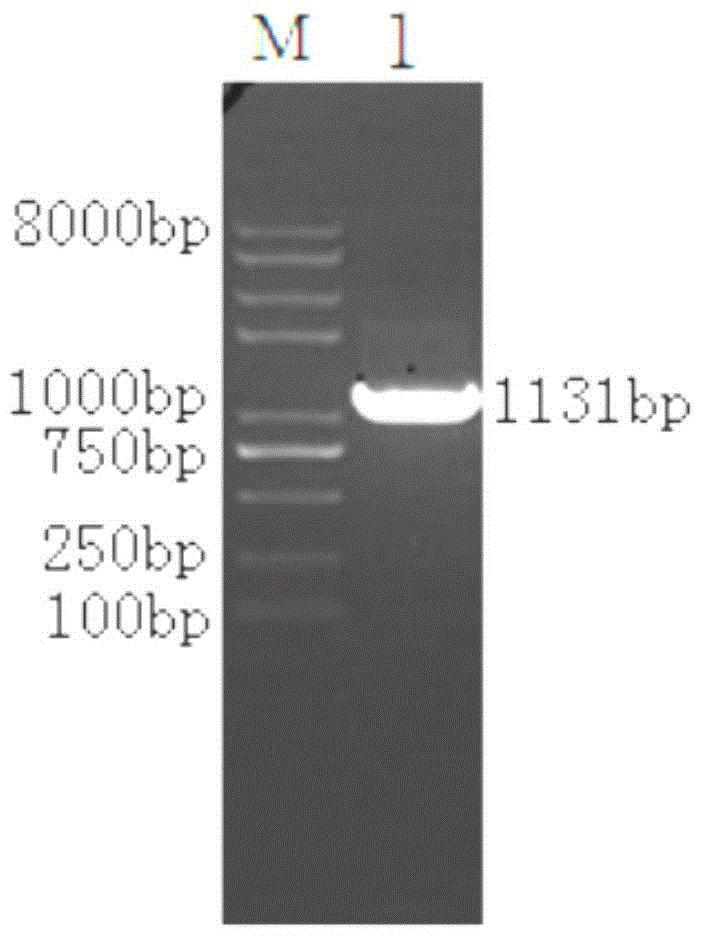 猪带绦虫TsSerpin B6重组蛋白及其应用