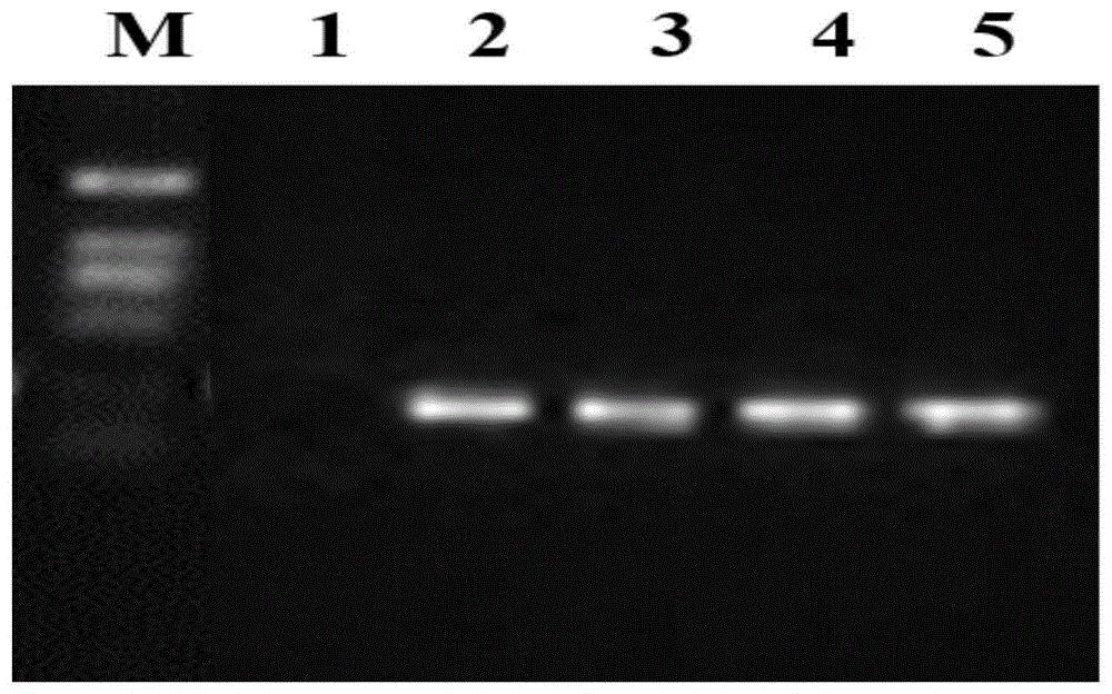 白叶枯病抗性相关基因Xa39(t)及其相关生物材料与培育抗白叶枯病水稻的方法