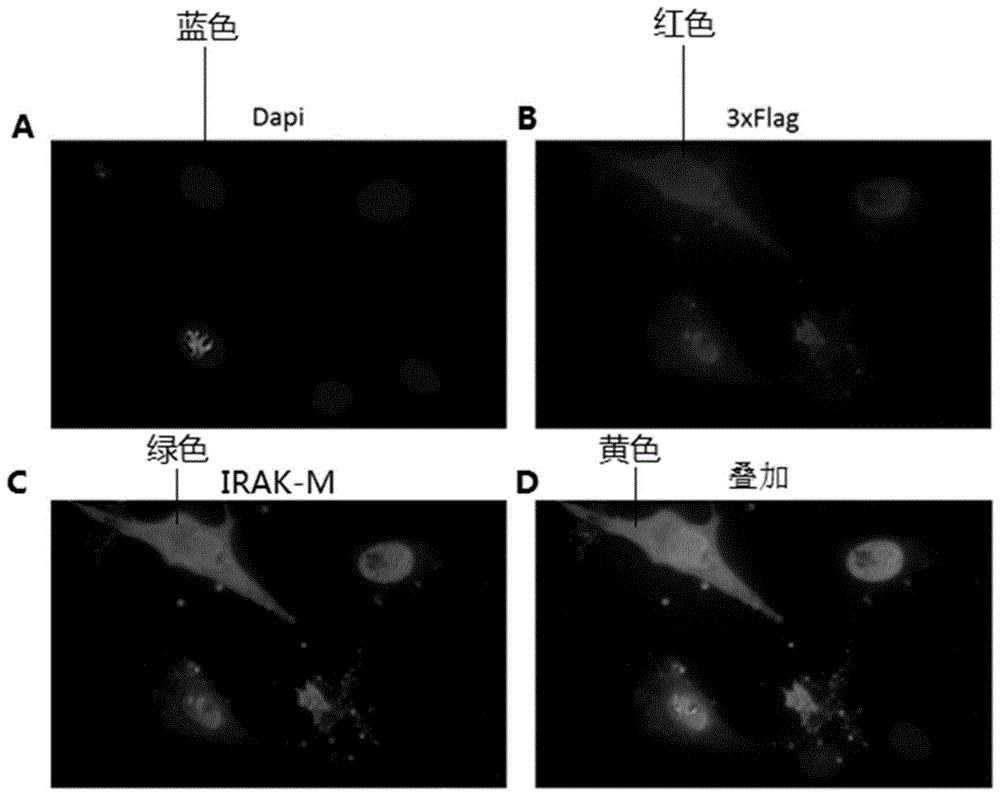 IRAK-M多克隆抗体及其制备方法