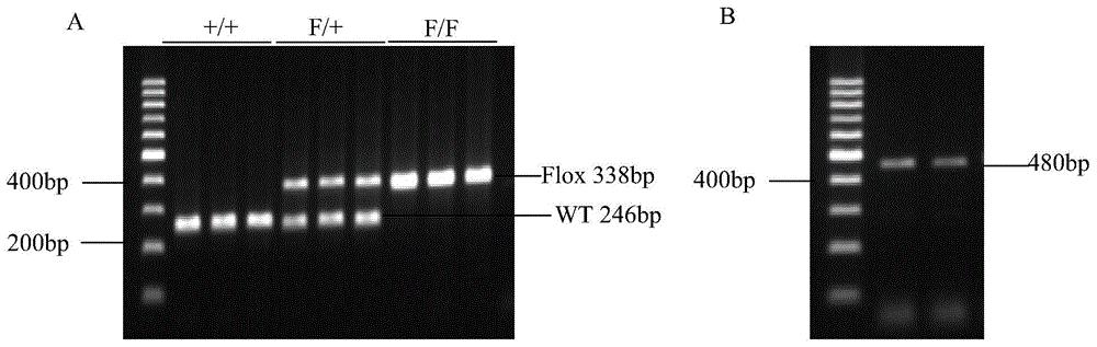 环指蛋白Rnf20基因的应用