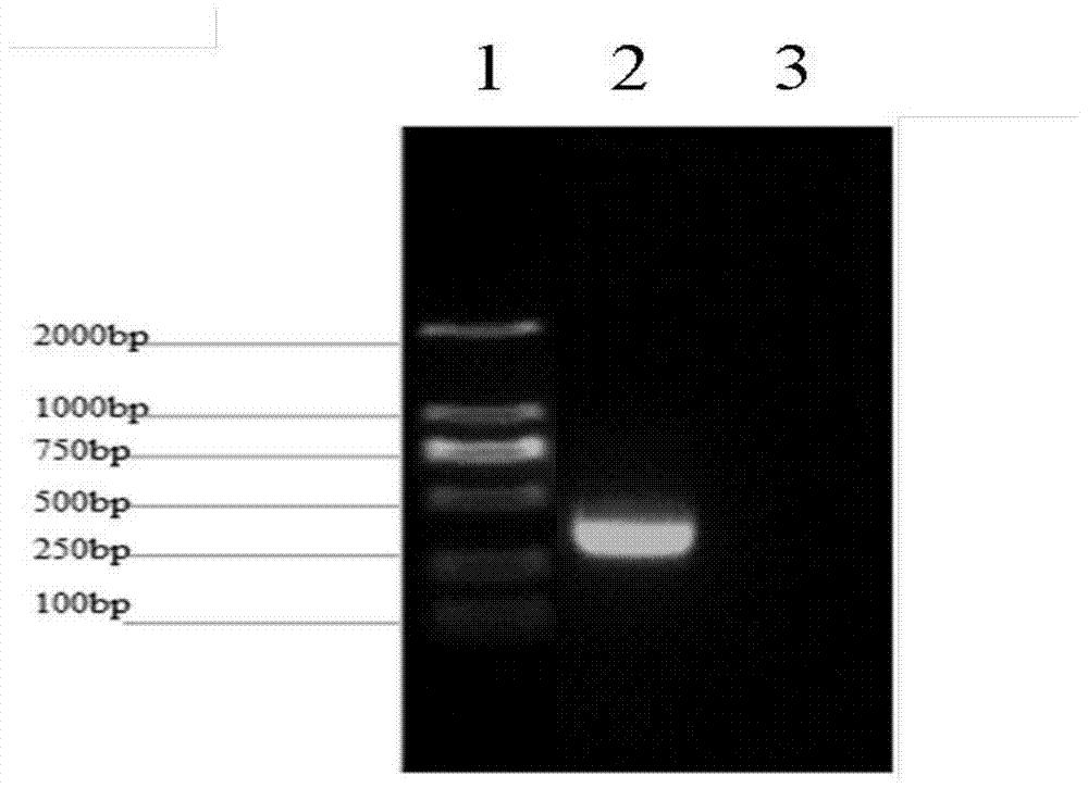 一种猪IGFN1蛋白多克隆抗体及其制备方法和应用