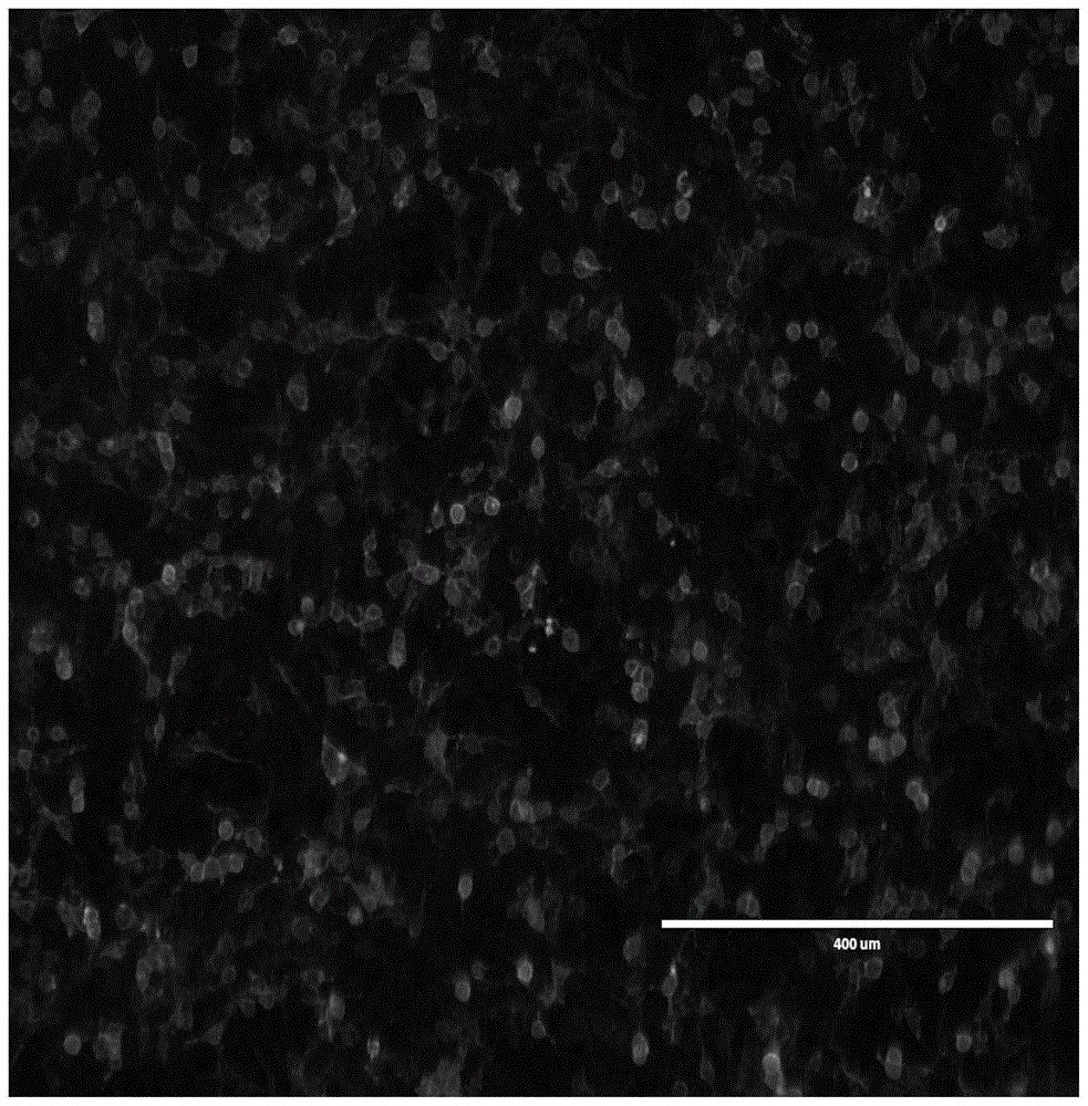 一种杂交瘤细胞株、类禽型H1N1猪流感病毒HA蛋白MAb、抗原表位及应用